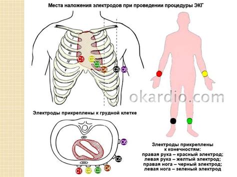 Подготовка к проведению ЭКГ