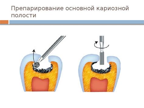 Подготовка к проведению хирургических процедур