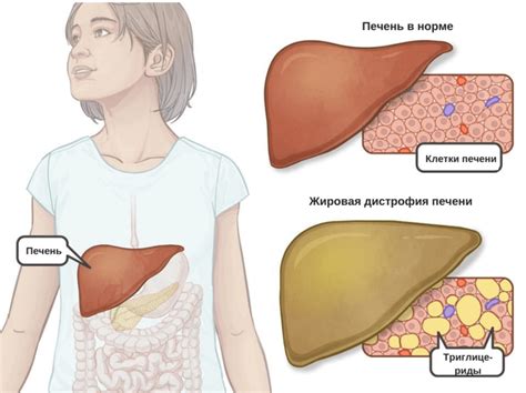 Поддержка функциональности печени