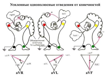 Подключение электродов к аппарату ЭКГ