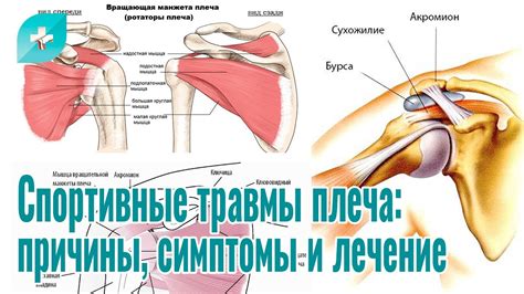 Понимание причин травмы плеча