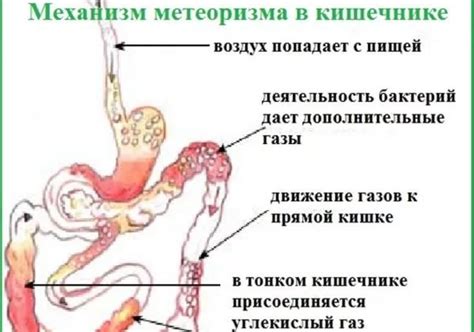 Понос - причины и лечение