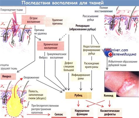 Последствия воспаления эктоцервикса