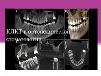 Последствия после проведения КЛКТ в стоматологии