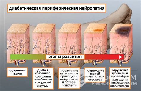 Последствия разрыва шва и возможные осложнения