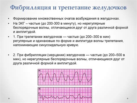 Последствия трепетания желудочков