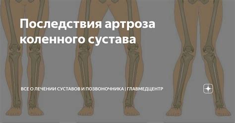 Последствия треска суставов