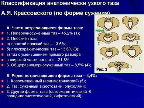 Последствия узкого таза для родового процесса