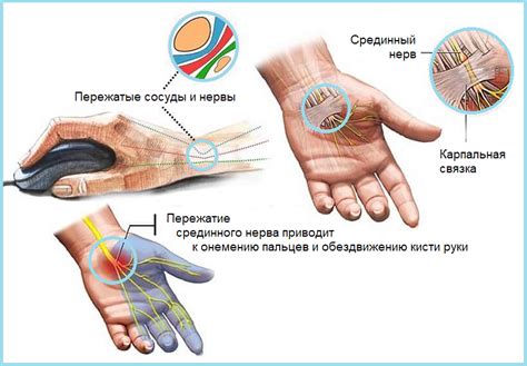 Почему давление на запястье выше плеча?