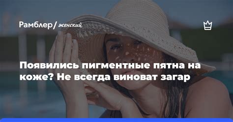 Почему загар на руках не всегда привлекателен