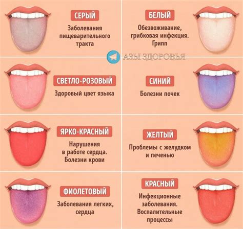 Почему милый язык может быть раздражающим