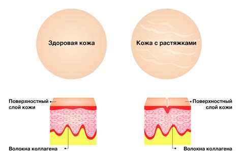 Почему появляются гаймориты?