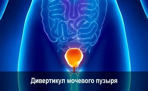 Почему утолщены стенки мочевого пузыря: основные причины и лечение