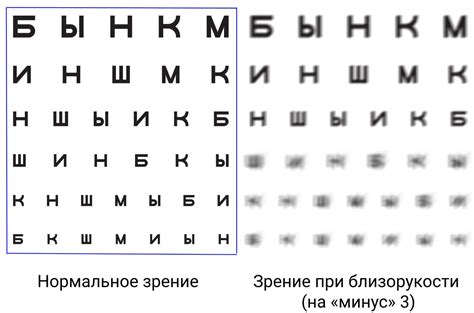 Правила коррекции и ухода за зрением минус 7