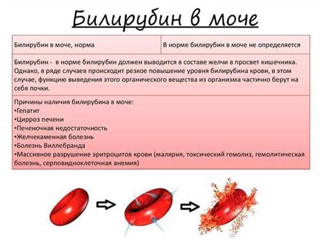 Правила профилактики повышенного билирубина