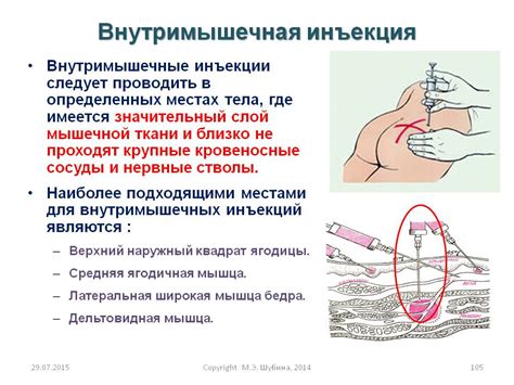 Правильная техника введения инъекции