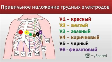 Правильное надевание электродов на тело