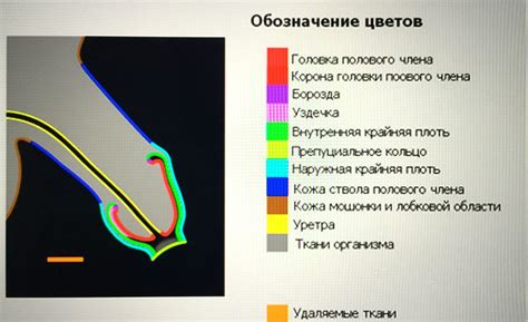 Правильное обрезание и стрижка