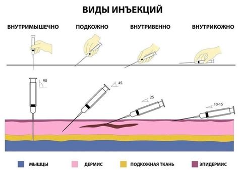 Правильный способ выполнения внутривенной инъекции лошади