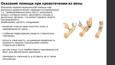 Предоставление первой помощи при проткновении вены