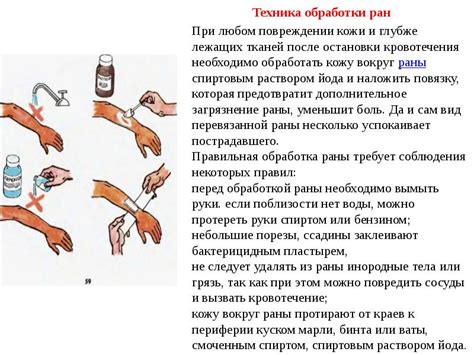 Предупреждение гнойных ран