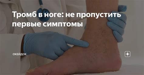 Предупреждение покалывания в венах на ноге