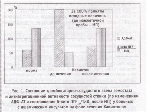 Преимущества лечения Кавинтоном в капельнице