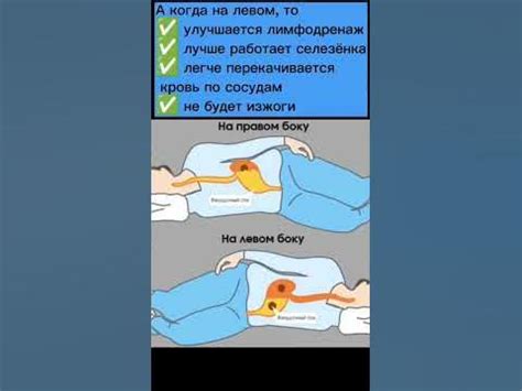 Преимущества сна на правом боку для определенных состояний