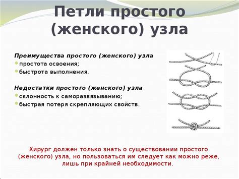 Преимущества узла цеппелин