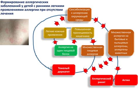 Признаки аллергии и ее влияние на здоровье