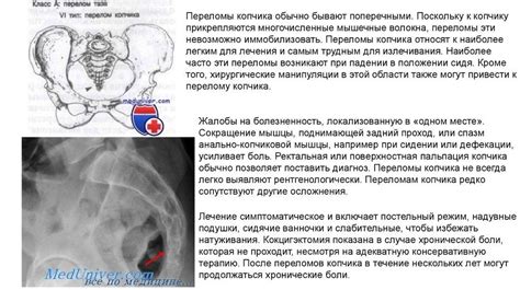 Признаки возможной травмы копчика