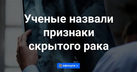 Признаки скрытого нравления парнем