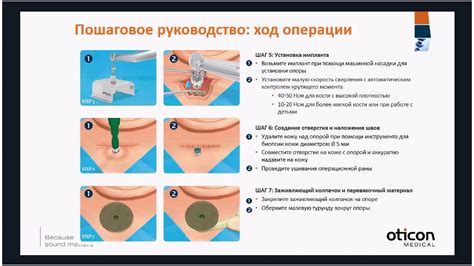 Применение датчика костной проводимости