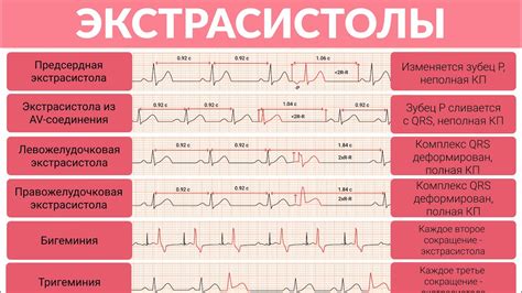 Примеры интерпретации ЭКГ: распознавание симптомов и диагнозов