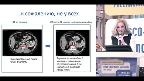 Принципы и методы химиотерапии при легочном раке