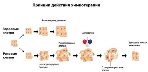 Принцип действия паллиативной химиотерапии