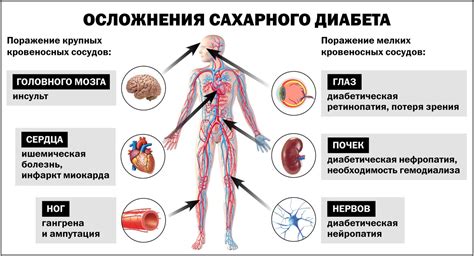 Причины возникновения 2 типа сахарного диабета