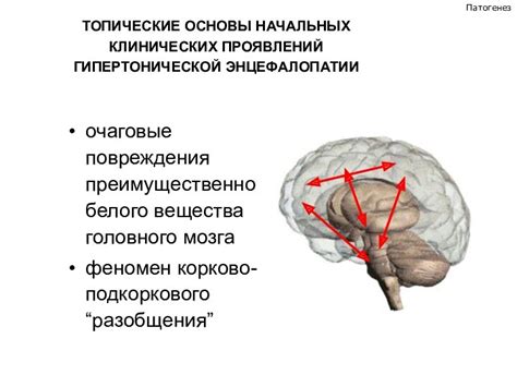 Причины гиперинтенсивности белого вещества головного мозга