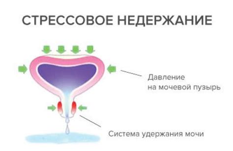 Причины давления на мочевой пузырь