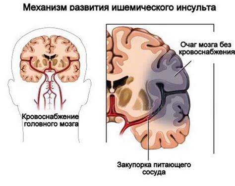 Причины дизритмии головного мозга у ребенка