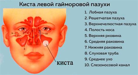 Причины затемнения в правой пазухе носа