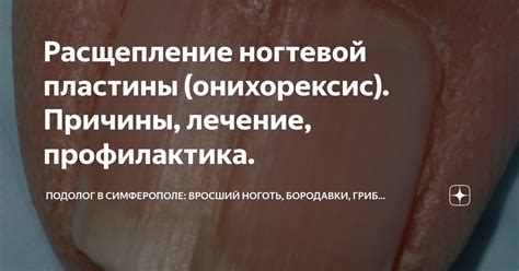 Причины и лечение повреждений ногтевой пластины