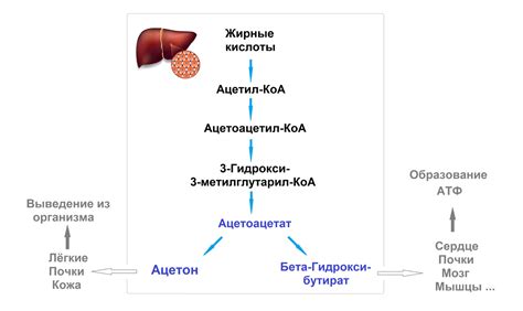 Причины и механизмы образования ацетона