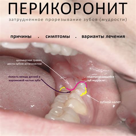 Причины и последствия удаления сайта из Яндекса