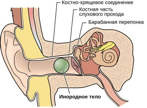 Причины и симптомы компрессии уха