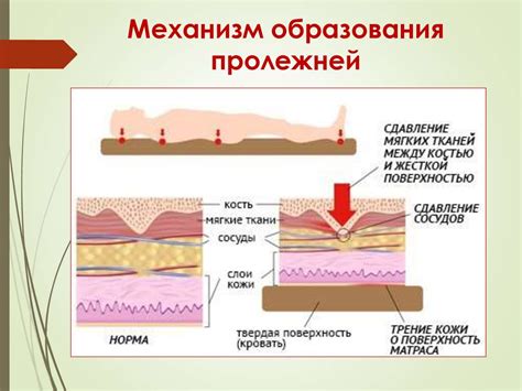 Причины образования липоидных тельц