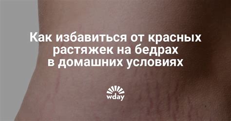 Причины образования растяжек на бедрах