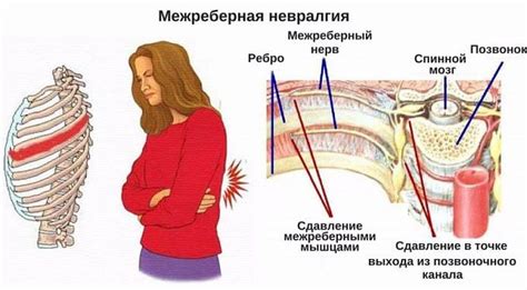 Причины онемения в области левой лопатки