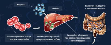 Причины повышенного билирубина в организме
