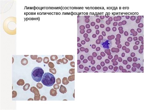 Причины понижения лимфоцитов